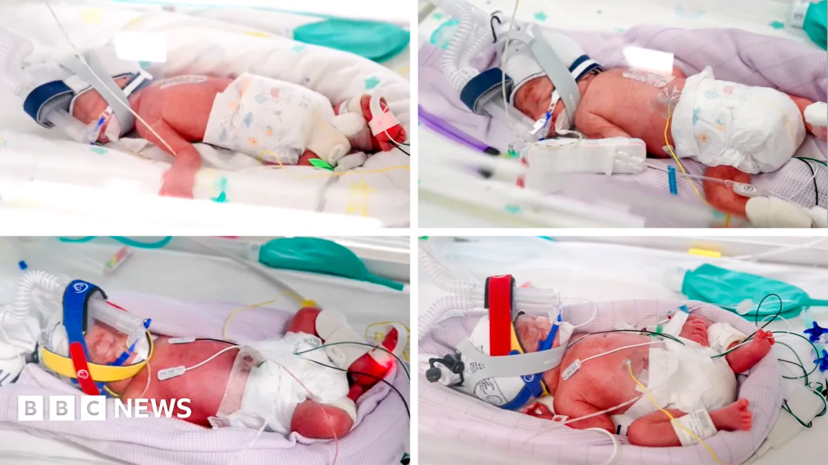 Brisbane Woman Gives Birth to Rare Identical Quadruplets in Australia