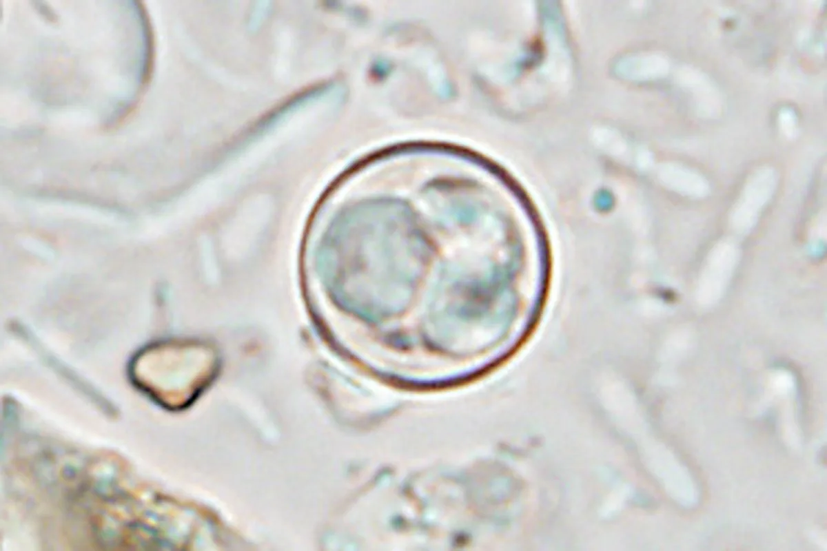 Cyclospora Parasite Outbreak Causes Rise in Illnesses Across Multiple US States