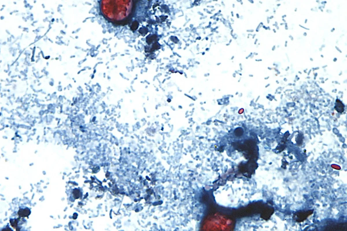 Cyclospora Parasite Outbreak Reaches Record Levels in the United States