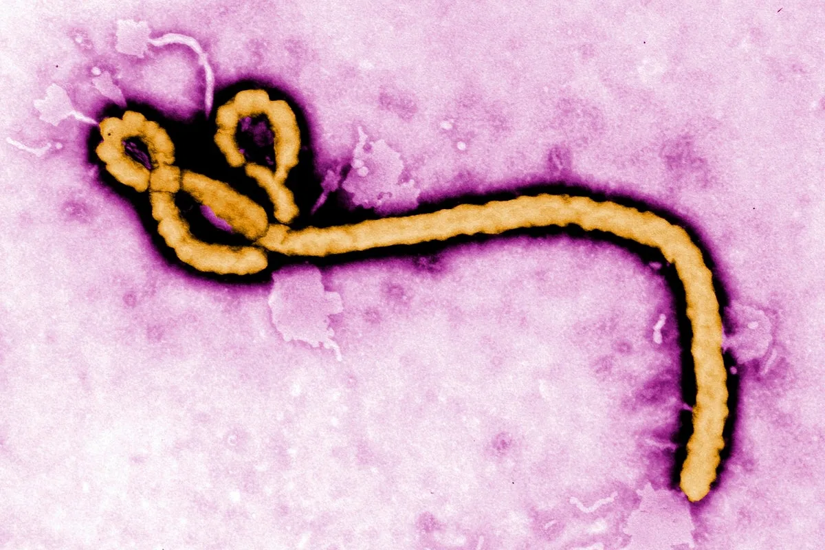 Ebola Outbreak in Congo Results in 65 Deaths and 246 Suspected Cases