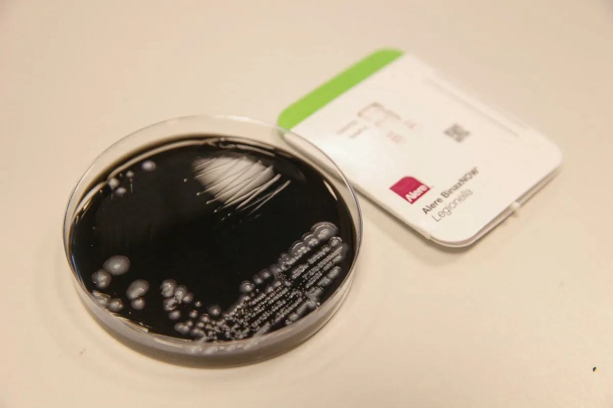 First Death Reported in Upper East Side Legionnaires' Disease Outbreak