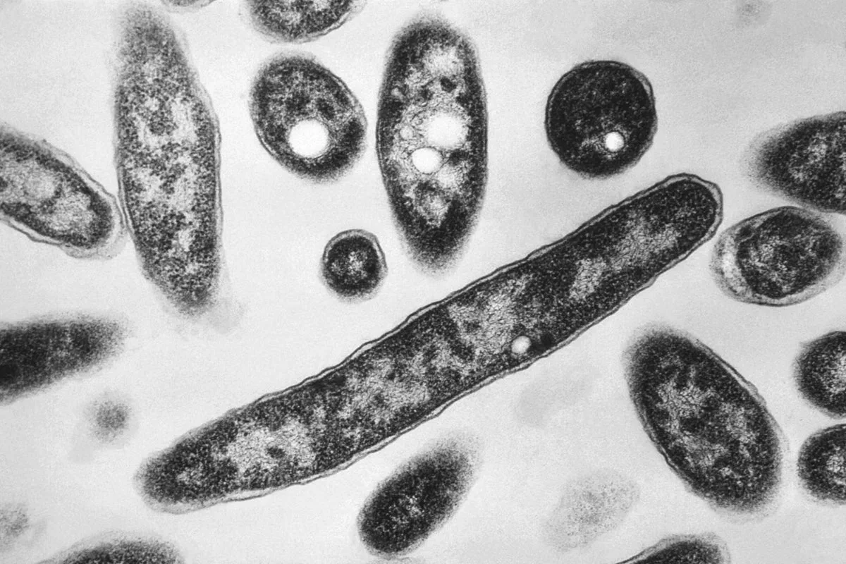 Legionnaires’ Disease Cluster Reported on New York’s Upper East Side
