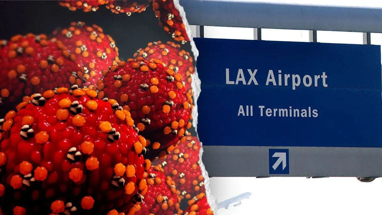 Measles Case Reported at LAX; Officials Warn of Possible Exposure at Airport and Hotel