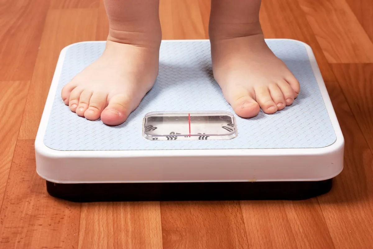 Severely Obese Young Children Referred to NHS Weight Management Clinics