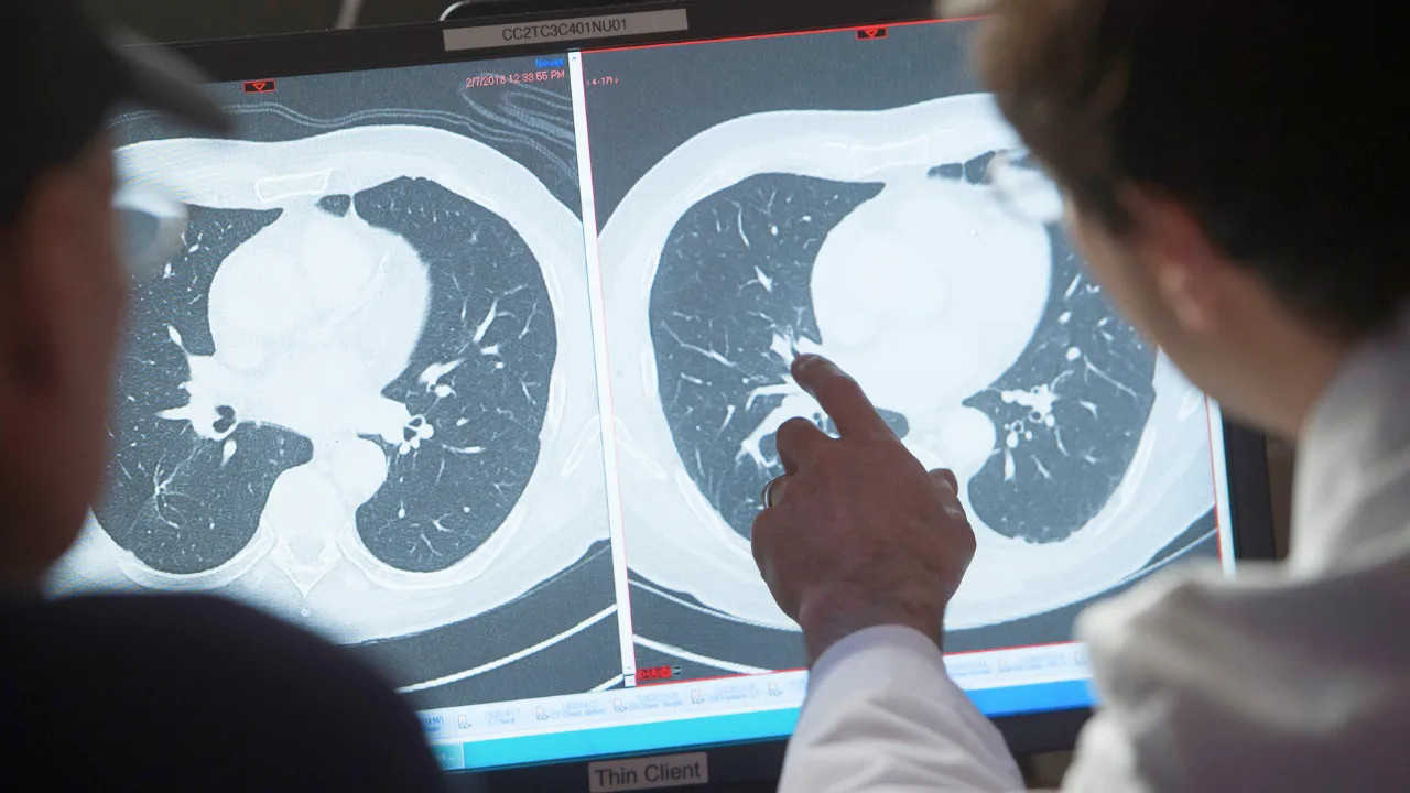 Study Estimates $185 Trillion Economic Impact for U.S. if Cancer Is Cured