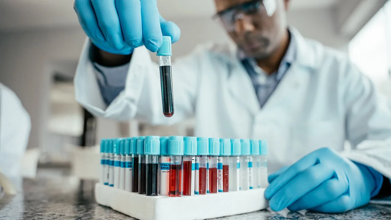 Study Links Blood Metabolites to Dementia Risk, Smoking Cessation Also Examined
