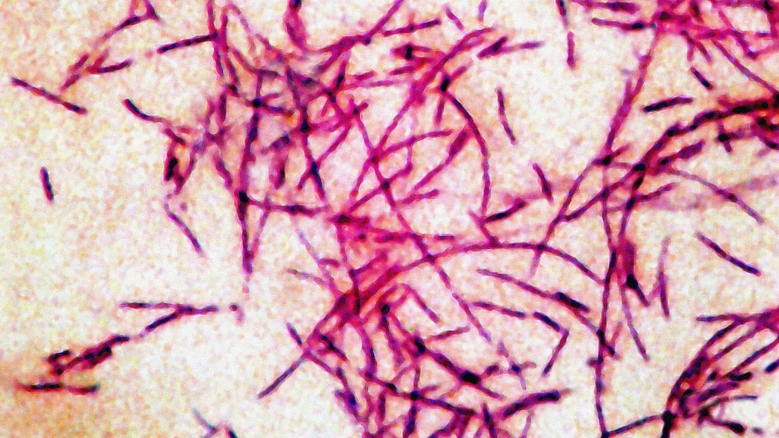 Third Death Reported in Manhattan Legionnaires' Disease Outbreak