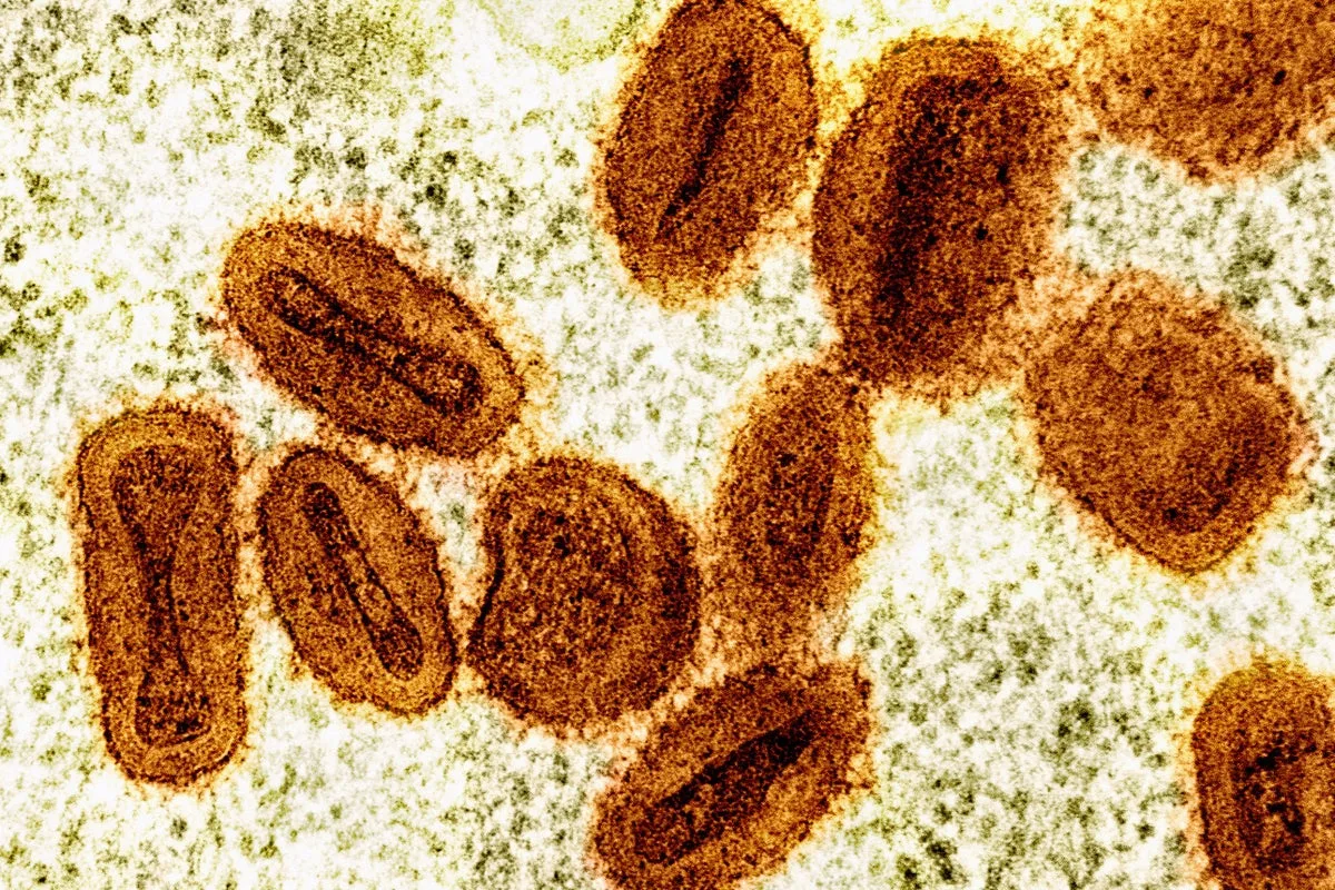 Two U.S. Scientists Charged With Smuggling Deactivated Mpox Virus From Africa