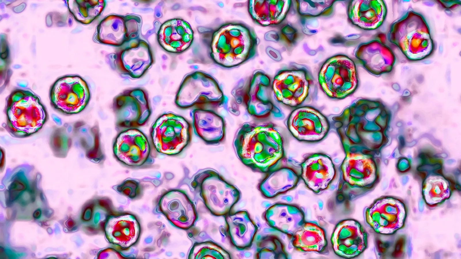 US Measles Cases Exceed 2,000 for Second Consecutive Year, CDC Reports