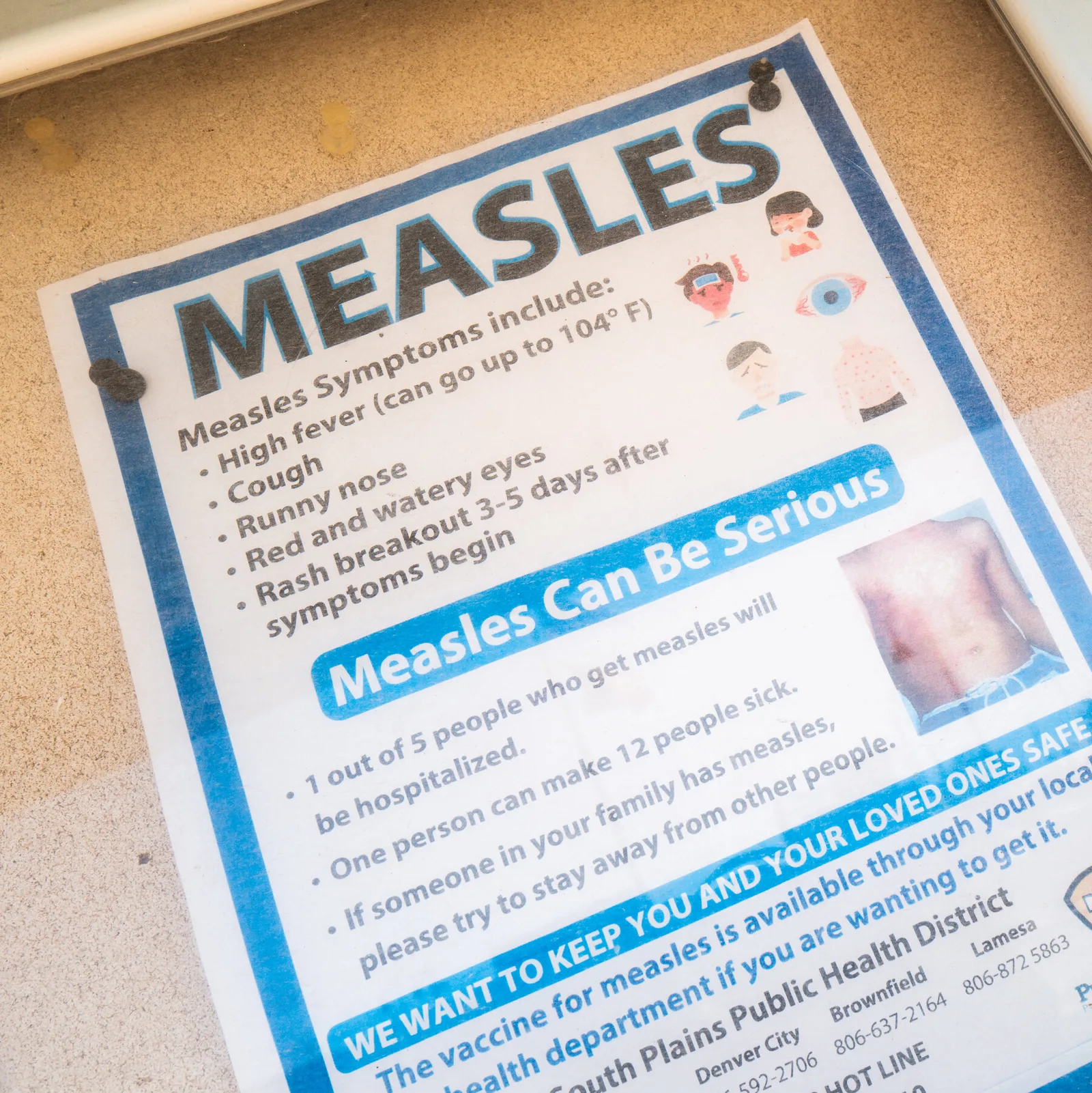 Utah Reports Nearly 600 Measles Cases; San Francisco Confirms First Case Since 2019